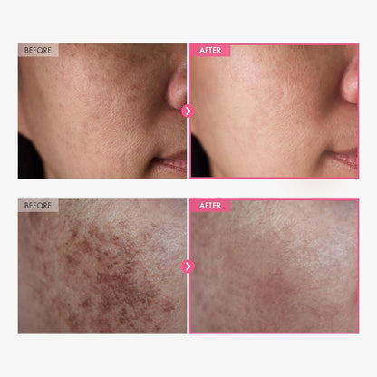 Dark Spot Correcting Cream (Arbutin + Tranexamic Formula)